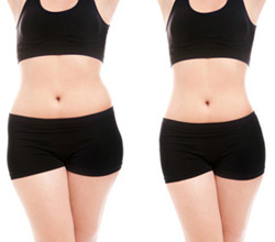 Pink Sands Spa NYC - NuShape Results