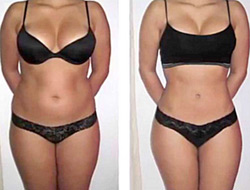 Pink Sands Spa NYC - NuShape Results